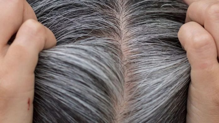 White Hair Home Remedies: You can turn white hair naturally black by applying these two things, know the method